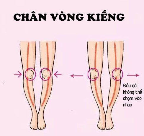 chan-vong-kieng